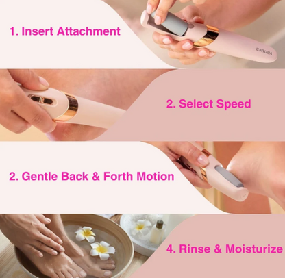 Stepoa Pro Callus Remover™