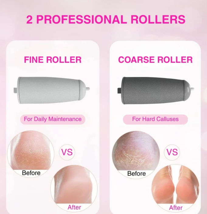 Stepoa Pro Callus Remover™